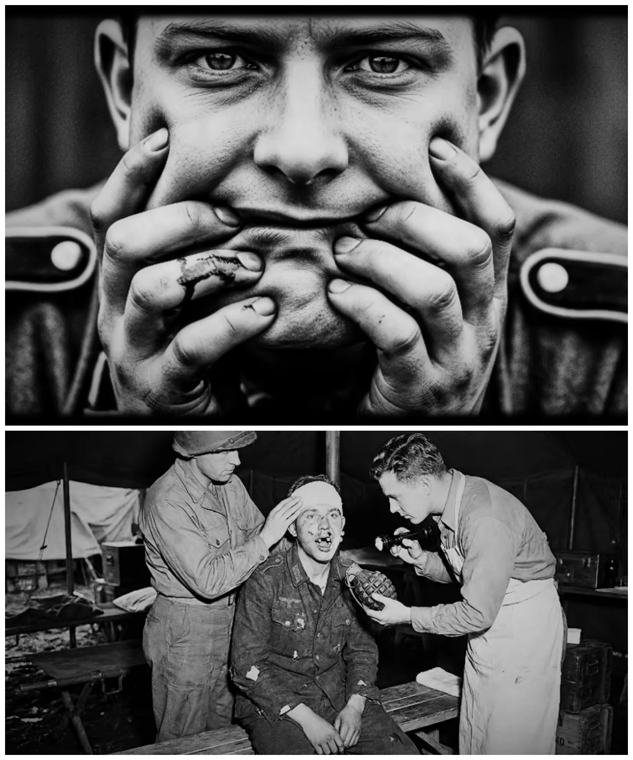 “My Teeth Are Gone” – A 21-Year-Old German POW Arrived With Smashed Mouth From Grenade Blast