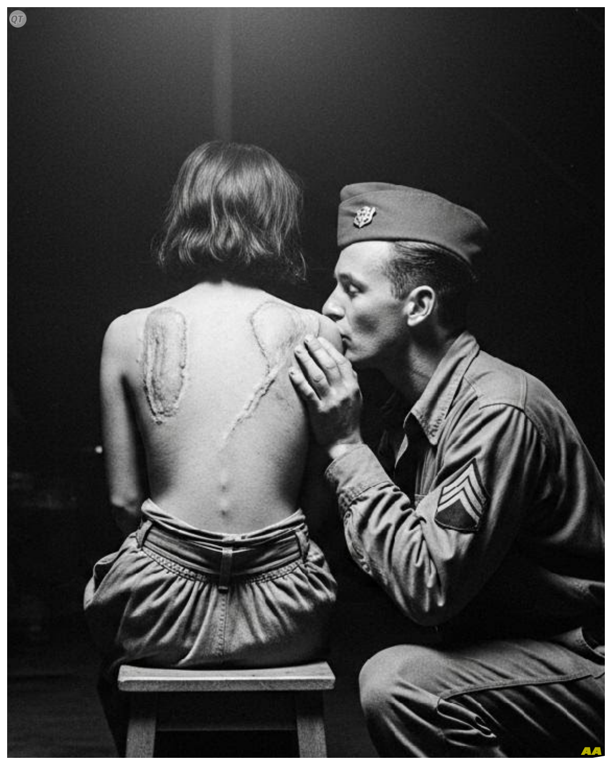 Show Us Your Scars — What Happened Next Left Japanese Women POWs Speechless