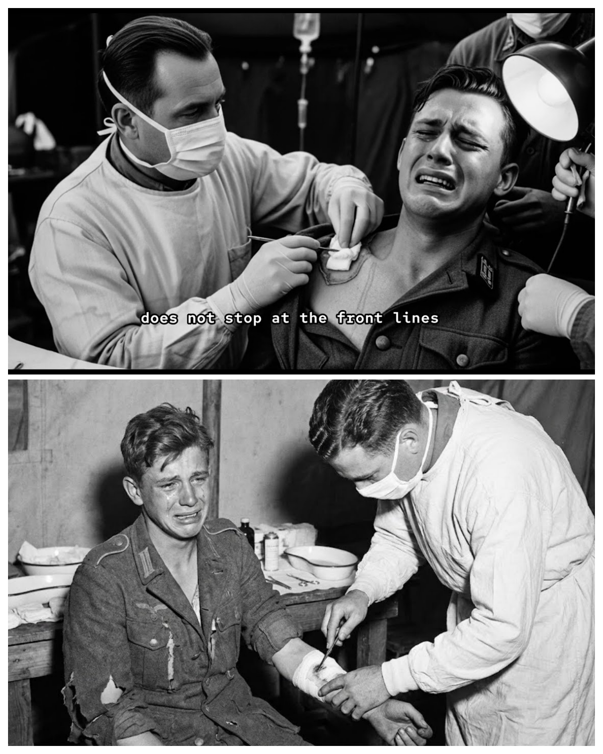 “Your Wound Is Infected…” — German POW Broke Down When American Surgeon Cleaned His Shrapnel Injury  What made a young German POW suddenly break down when an American surgeon quietly examined his shrapnel wound—and what hidden truth did the medical team discover during that tense moment inside a wartime camp hospital? Could this emotional scene reveal an untold story of survival, fear, and unexpected humanity between enemies? The little-known wartime account continues to spark curiosity—click the article link in the comments to uncover the full story.