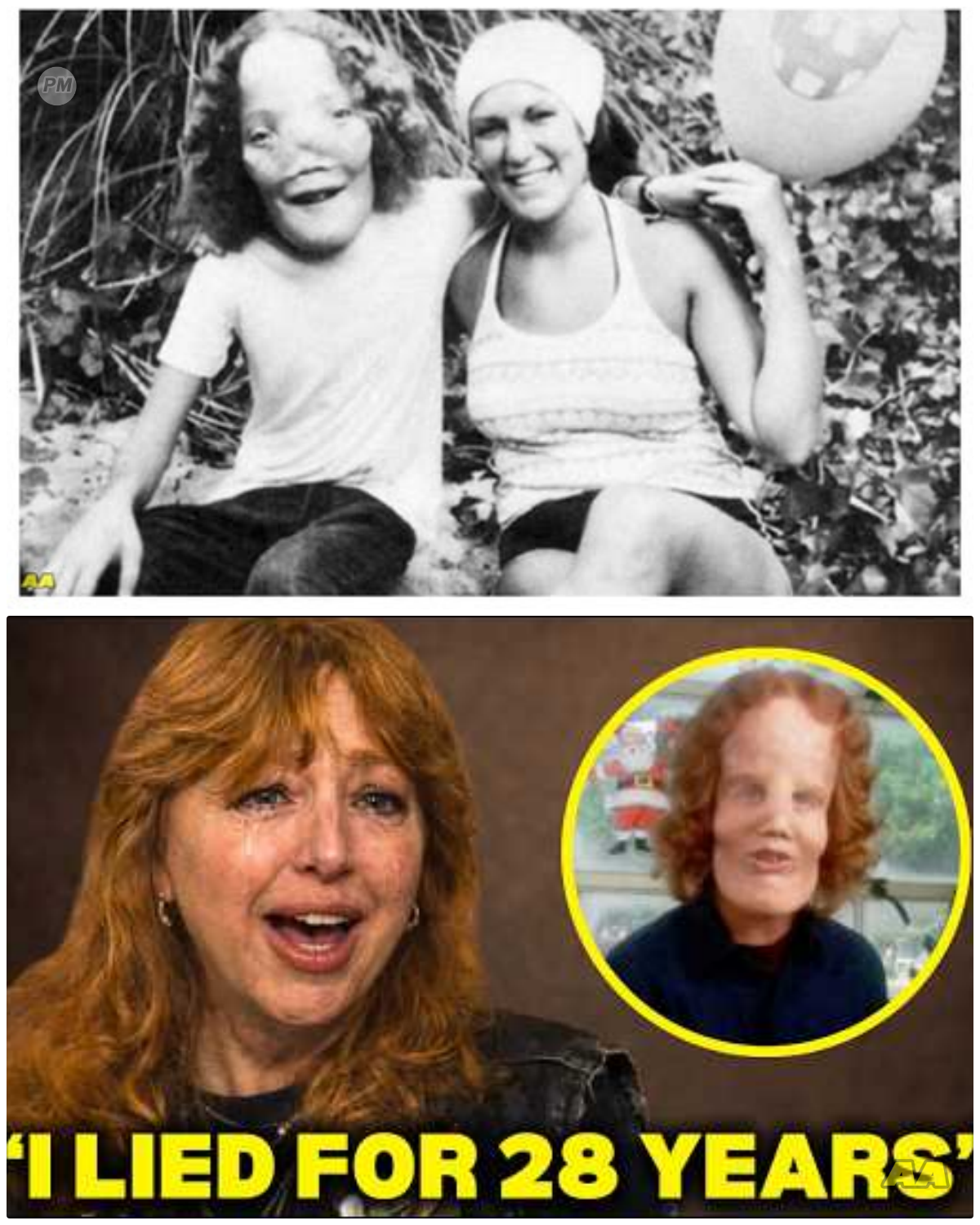 Before She Died, Rocky Dennis’s Mom FINALLY Broke Silence About Rocky Dennis And It’s BAD. Before her tragic passing, Rocky Dennis’s mother finally broke her silence about her son, and the truth is far darker than anyone could have imagined. The heart-wrenching details of Rocky’s life, his struggles, and the shocking things that went on behind closed doors have left the world reeling. What did his mother reveal that no one expected? Find out the devastating truth that has been hidden for decades! 👇