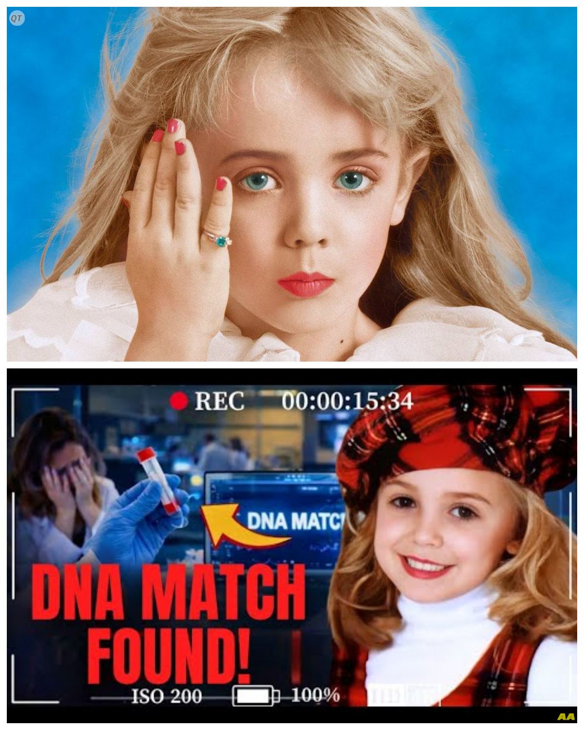 “The Shocking Truth: ‘It’s Not Who You Think!’ – JonBenet Ramsey’s DNA Reveals a Disturbing Twist!” In a groundbreaking revelation that has sent shockwaves through the true crime community, new DNA evidence in the JonBenet Ramsey case points to a suspect no one expected, with insiders exclaiming, “It’s not who you think!” as they unveil the chilling implications of this discovery, raising haunting questions about the investigation and the dark secrets that have lingered for decades; prepare for a deep dive into a mystery that just got even more twisted.  The full story is in the comments below.