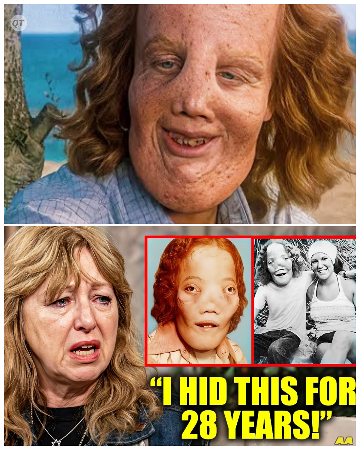 “Rocky Dennis’ Mother’s Emotional Revelation: The Truth About Her Son Before She Passed!” -ZZ In a heartbreaking update, Rocky Dennis’ mother shared her thoughts and feelings about her son shortly before her death, revealing the truths that shaped their lives. Her poignant words highlight the struggles and victories they experienced together, painting a vivid picture of Rocky’s indomitable spirit. What powerful insights did she provide, and how do they resonate with the legacy of her beloved son? Prepare for an inspiring exploration of love and courage!