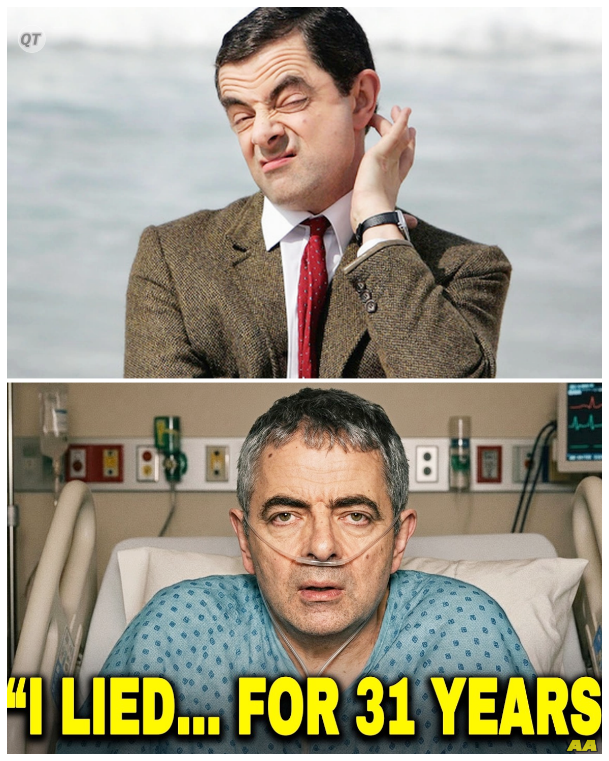 “Mr. Bean’s Shocking Confirmation: The Truth Behind the Rumors After 31 Years!” -ZZ  In an unexpected twist, Mr. Bean has confirmed the rumors that have surrounded him for over three decades, leaving fans buzzing with excitement. As he opens up about his experiences, the revelations shed new light on the character’s enduring popularity. What did he reveal, and how does it affect the legacy of Mr. Bean? Get ready for an intriguing update from this comedy legend!