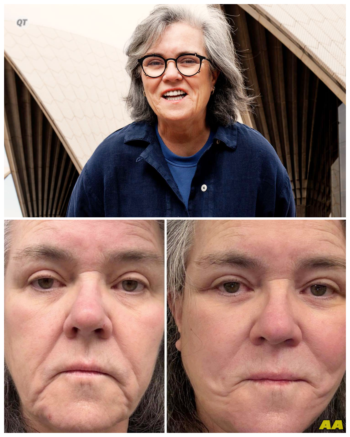 “ROSIE O’DONNELL’S BEAUTY SECRET: A Facelift That Will Leave You Speechless—Costing More Than a Car!” -ZZ  In a shocking admission, Rosie O’Donnell has disclosed her secret facelift, a stunning procedure that came with a price tag higher than that of a luxury car! As she embraces her new appearance, the beloved star opens up about the pressures of aging in the public eye. What inspired her to take this step, and how will it affect her public persona? The full story is in the comments below.